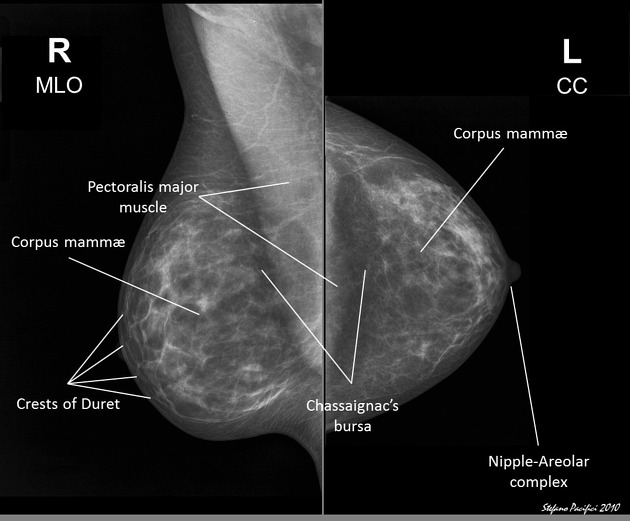 How Mammography Works: A Complete Guide for Women